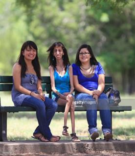 Lizzie Velasquez feet photo 18