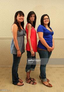 Lizzie Velasquez feet photo 17