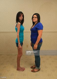 Lizzie Velasquez feet photo 16