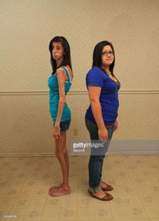 Lizzie Velasquez feet photo 15