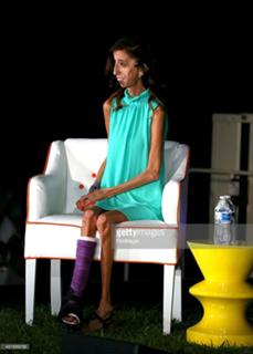 Lizzie Velasquez feet photo 12