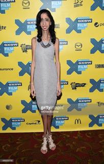 Lizzie Velasquez feet photo 11