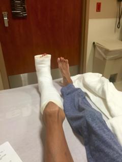 Lizzie Velasquez feet photo 9