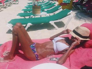 Lizzie Velasquez feet photo 1