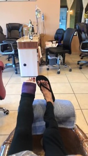 Lizzie Velasquez feet photo 17