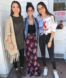 Lizzie Velasquez feet photo 10