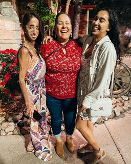 Lizzie Velasquez feet photo 6