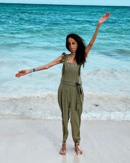 Lizzie Velasquez feet photo 5