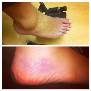 Logan Stanton feet photo 8