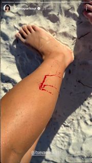 Lorena Abreu feet photo thumbnail