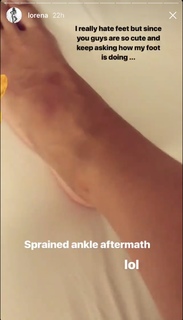 Lorena Rae feet photo thumbnail