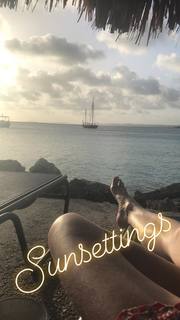 Lotte Verbeek feet photo 11