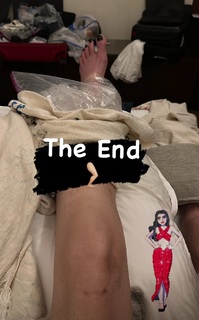 Luciana Gimenez feet photo thumbnail