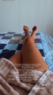 Lusine Hayrapetyan feet photo 8