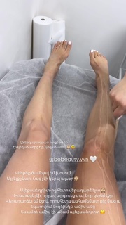 Lusine Hayrapetyan feet photo 7
