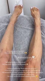 Lusine Hayrapetyan feet photo 5
