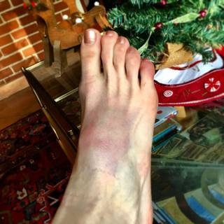 Lyndon Smith feet photo thumbnail