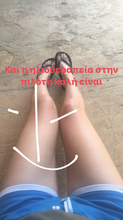 Manto Gasteratou feet photo 17
