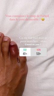 Marine Lorphelin feet photo thumbnail