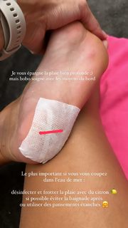 Marine Lorphelin feet photo thumbnail