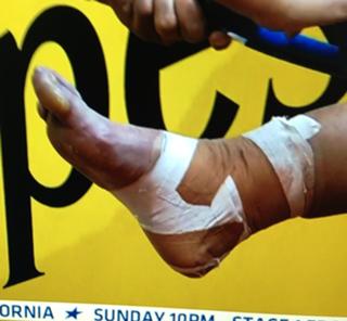 Marion Bartoli feet photo 19