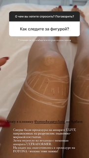 Mariya Kravchenko feet photo 4