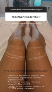 Mariya Kravchenko feet photo 3