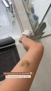 Marta Díaz feet photo thumbnail