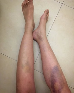 Martyna Wojciechowska feet photo 10