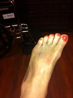 Mary Lou Retton feet photo 10