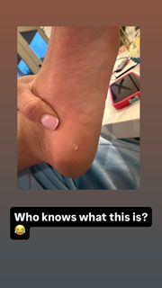 Maryna Moroz feet photo 5