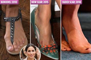Meghan Markle feet photo thumbnail