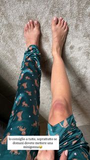 Melita Toniolo feet photo 3