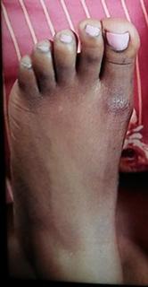 Michaela Coel feet photo 13