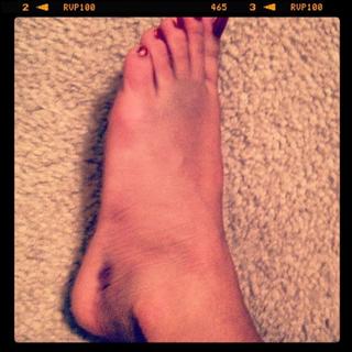 Mickie James feet photo thumbnail
