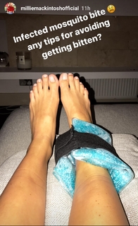 Millie Mackintosh feet photo thumbnail