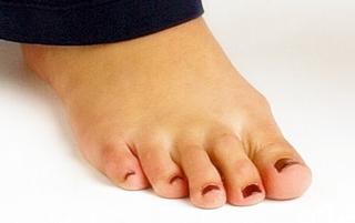 Miranda Kerr feet photo thumbnail