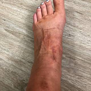 Miriam Höller feet photo 3