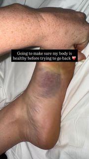 Molly Carlson feet photo thumbnail