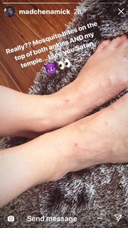 Mädchen Amick feet photo thumbnail