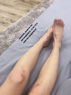 Nadezhda Dorofeeva feet photo thumbnail