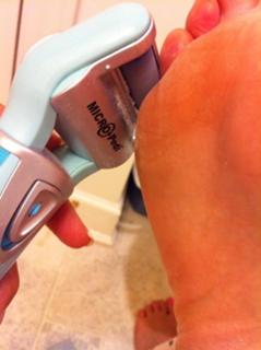 Nancy Hornback feet photo thumbnail