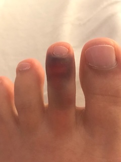 Naomi Kyle feet photo thumbnail