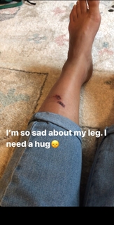 Nargis Fakhri feet photo thumbnail