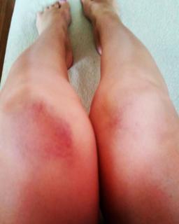 Nives Celzijus feet photo thumbnail