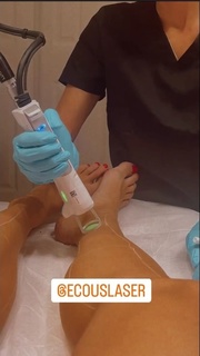 Nuki Koshkelishvili feet photo 18