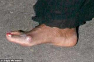 Oprah Winfrey feet photo thumbnail