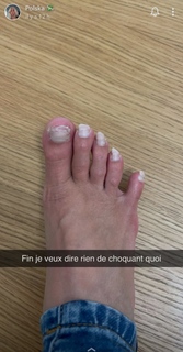 Polska feet photo thumbnail