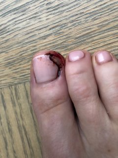 Poppy Delevingne feet photo thumbnail