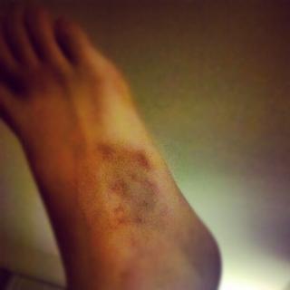 Rachel Tietz feet photo 14